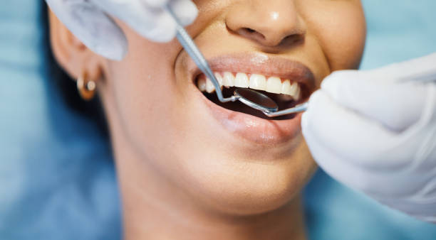Best Emergency Wisdom Teeth Removal in Moyock, NC